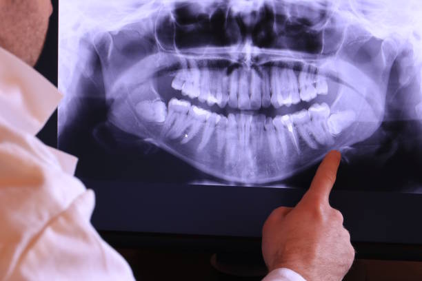 Best Emergency Tooth Extraction in West Portsmouth, OH